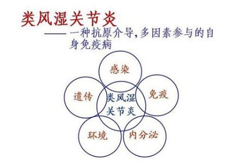 如何诊断儿童是不是得了类风湿?儿童类风湿预防?