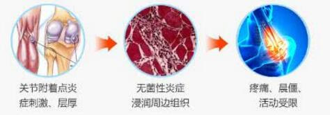 类风湿关节炎有哪些危害？对人体影响大不大？